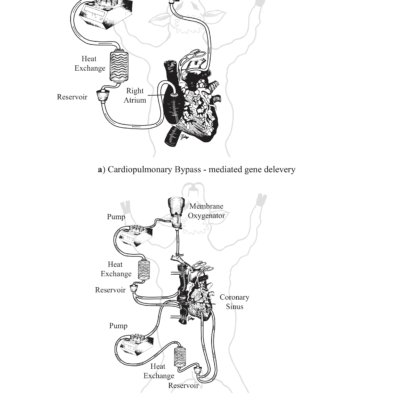 Cardiopulmonary Bypass